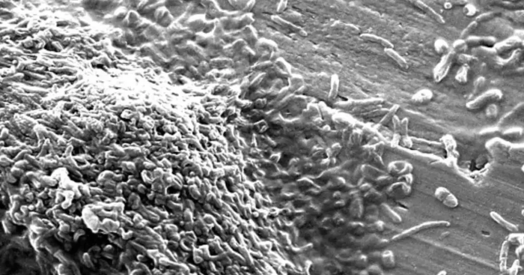Imagen microscópica de bacterias Legionella pneumophila colonizando un biofilm en una instalación de agua